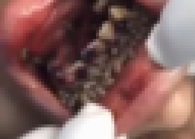 【閲覧注意】歯を磨かない子供にこの動画を見せたら100％磨くんじゃないか