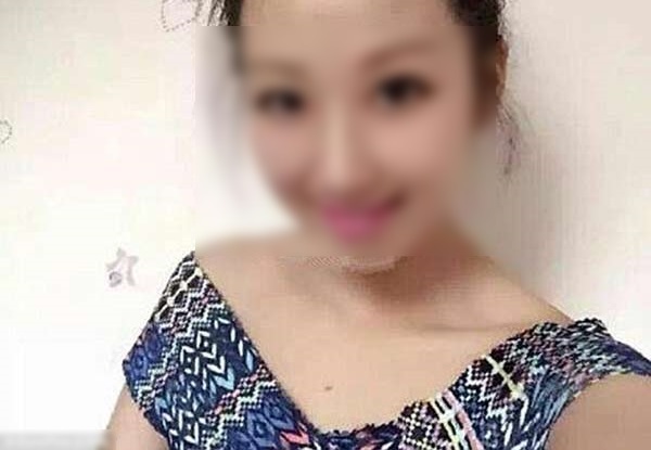 【閲覧注意】ウェイターと喧嘩して熱湯をかけられた女性、めちゃくちゃ美人だった…