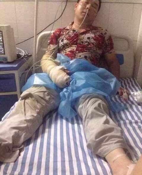 kitaec-pojmal-jadovituju-zmeju_03