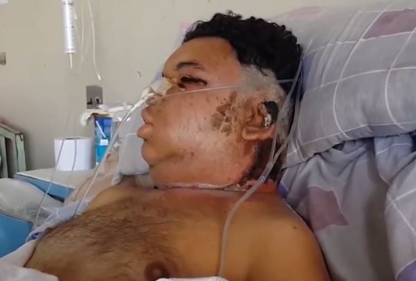 ukus-samogo-yadovitogo-pauka_02