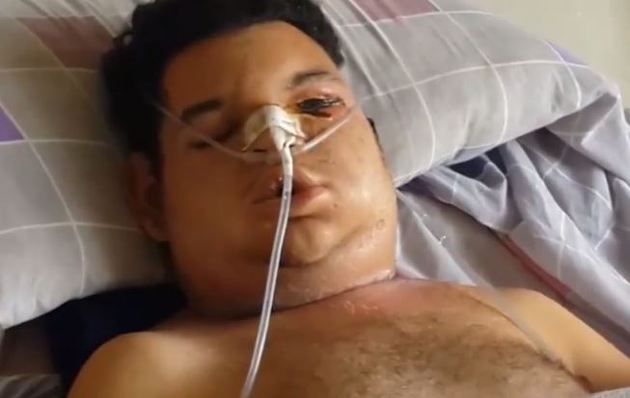 ukus-samogo-yadovitogo-pauka_03