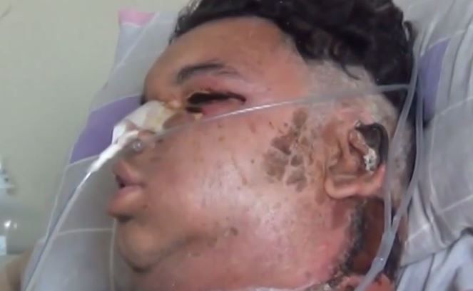 ukus-samogo-yadovitogo-pauka_04