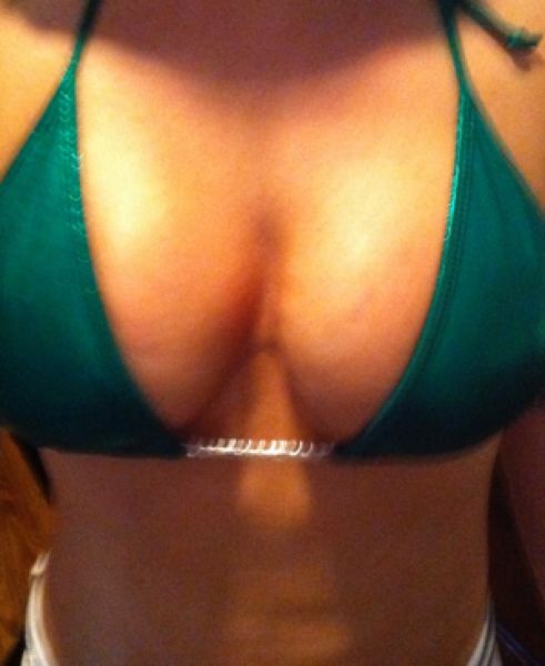 vampirskaja-podtjazhka-grudi_02