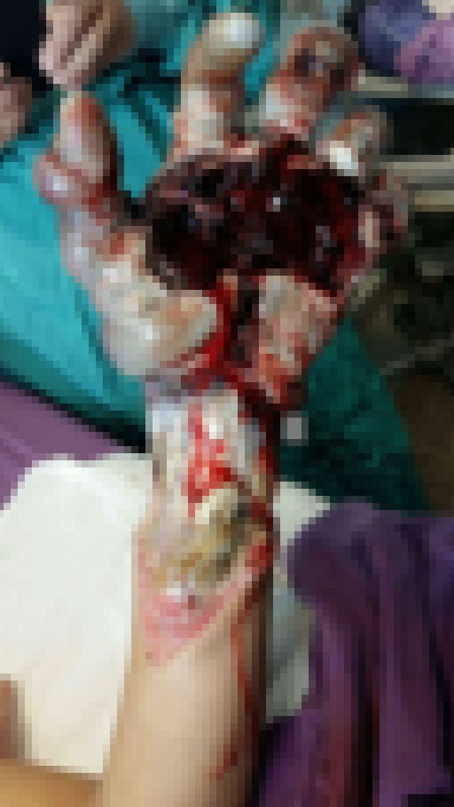 kako-eq71SNiZAfYJWGp8