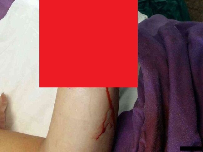 lLMtAmeYgDouYsl1449622220