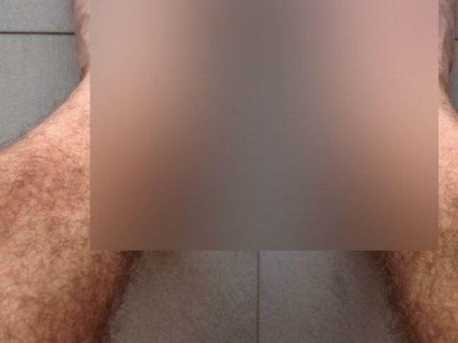 【画像】プロのキックボクサーの「足」がヤバすぎる・・・