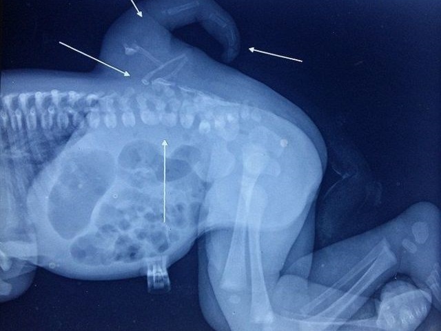 nCVKX_9pnGqx4Kb1456631590