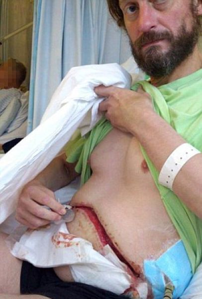 posledstvija-ukusa-skorpiona_02