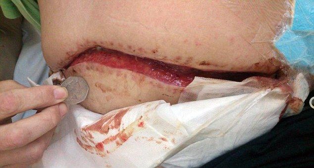 posledstvija-ukusa-skorpiona_03