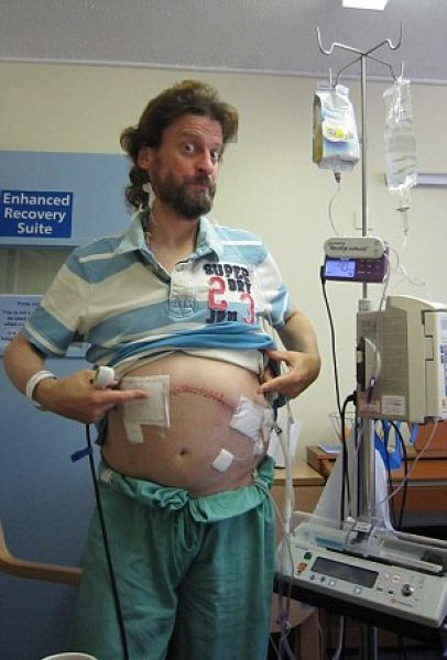 posledstvija-ukusa-skorpiona_04