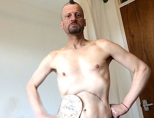 posledstvija-ukusa-skorpiona_05