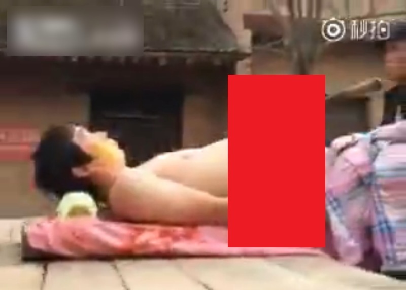 【閲覧注意】なんだこれ…？ケンカで病院に運ばれた村人の姿が「衝撃的過ぎる」と話題に