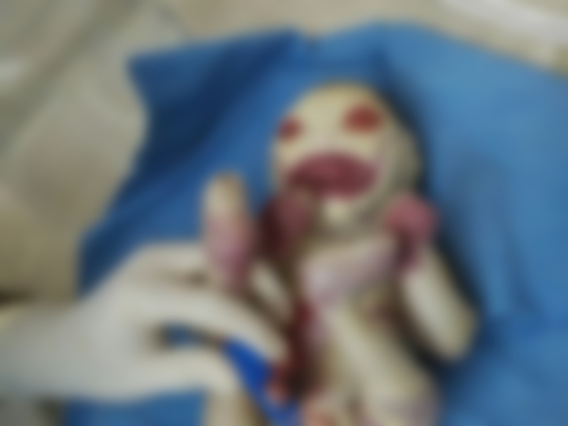 NMBbuT4DZRd7Rpp1466579904_1466579916