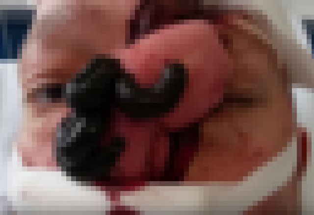 【超！閲覧注意】 「医療用ヒル」とかいう恐ろしい生物