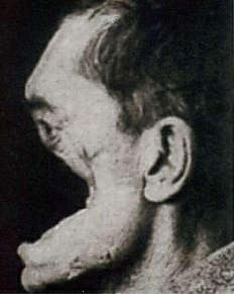 retro-plasticheskaja-operacija_01