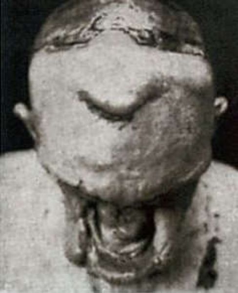 retro-plasticheskaja-operacija_03