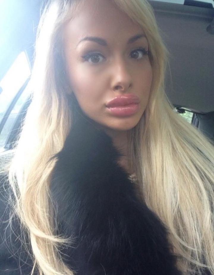 UrodRu20160721mukl_03