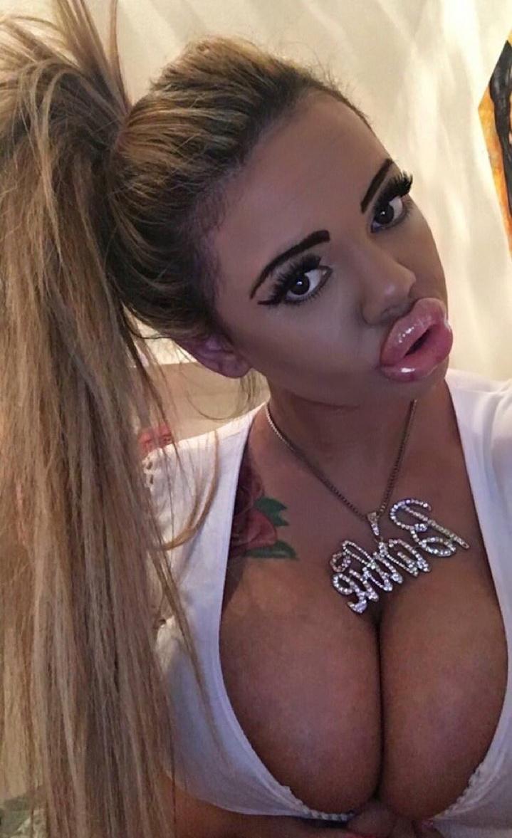 UrodRu20160721mukl_08