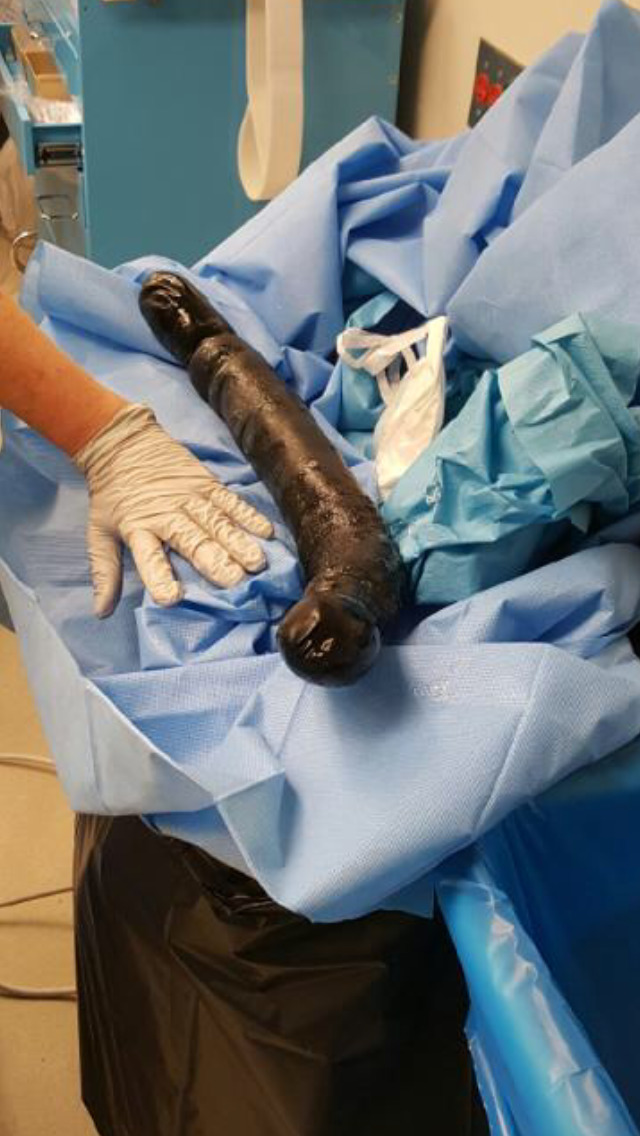 XDYfvJCbHqA74xO1471572639_1471572686