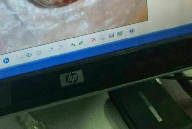 【閲覧注意】中国人のニートに対する仕打ち・・・（画像）