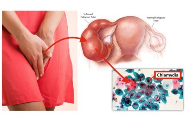 1ojnytjisqqt7su1480214401_1480214406