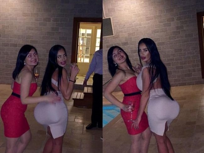 １００回整形した女、とんでもない姿に・・・（画像）