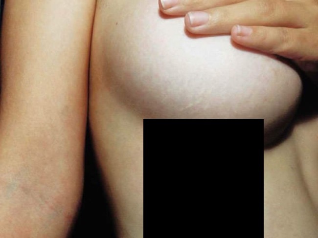 おっぱいのタトゥー、女子の間で流行る・・・（画像）