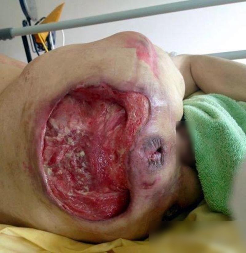 4ltpgyyjt2uwjen1481334422