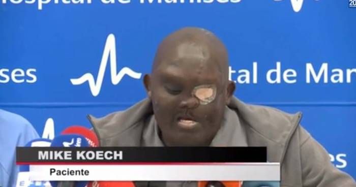 muzhchina-s-opuholju-na-lice_02