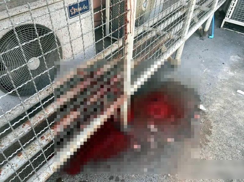 【閲覧注意】がん患者、がんで死ぬまでもう待てなかった・・・（画像）