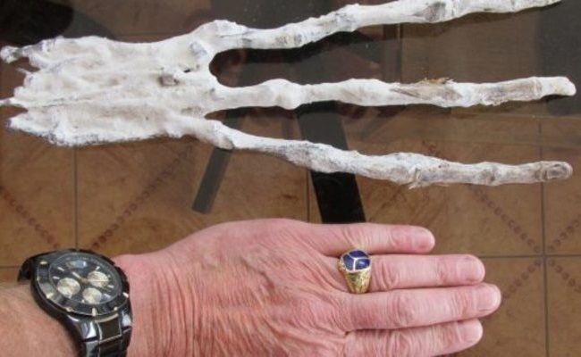 【画像】ペルーで発見された「エイリアンの手」⇒ レントゲン写真撮った結果…