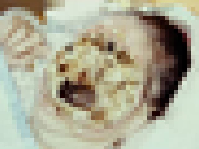 【閲覧注意】見た瞬間「あ、この人もう無理だな」って分かる癌患者の画像