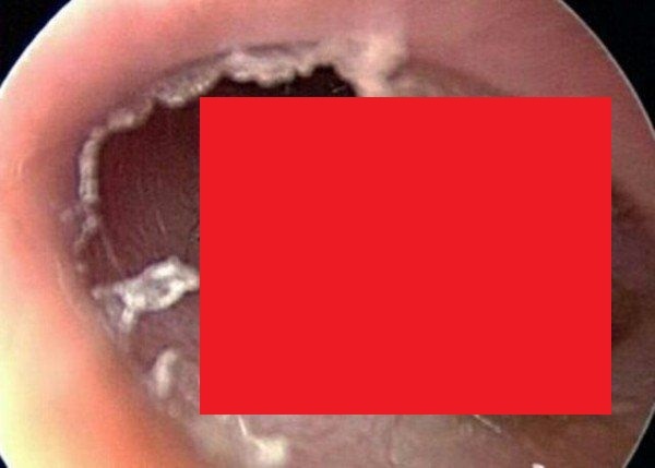 oE0cosgMoP1UpyQ1487124815