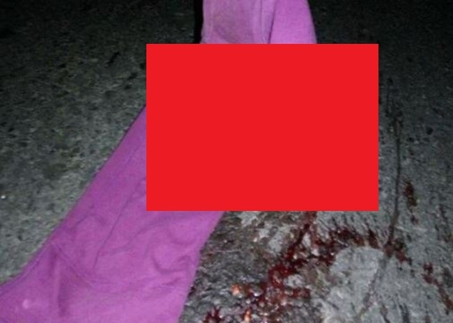 【閲覧注意】女性、中身だけ出てしまう（画像）