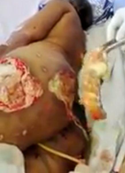 UrodRu20170307vzryv-zadnicy_02