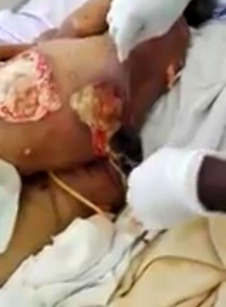 UrodRu20170307vzryv-zadnicy_03