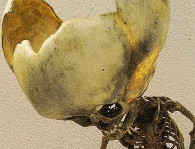 awVBtKb5CzQ0r951489980606