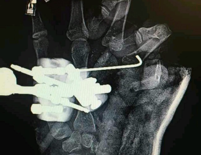 d5obv0PWW6uZDKy1493107489