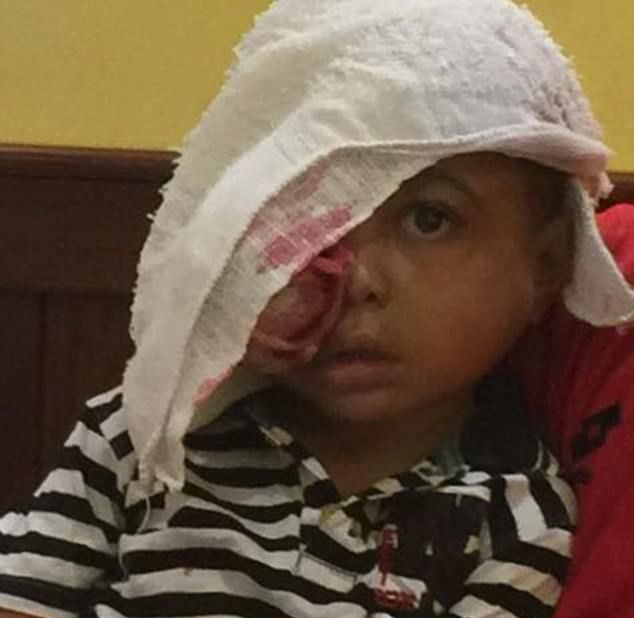 rebenok-s-opuholju_01