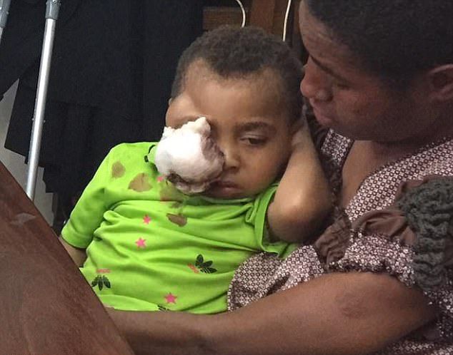 rebenok-s-opuholju_02