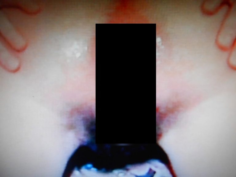 黒人男性に犯された白人美少女のマ●コとア●ル、完全に終わる・・・（画像）