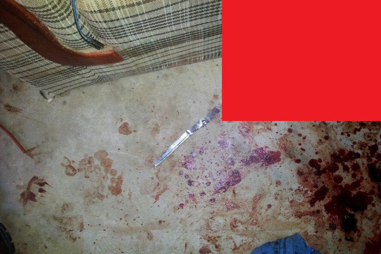 【閲覧注意】障害者女性、男性のチ●コをこうしてしまう・・・（画像）
