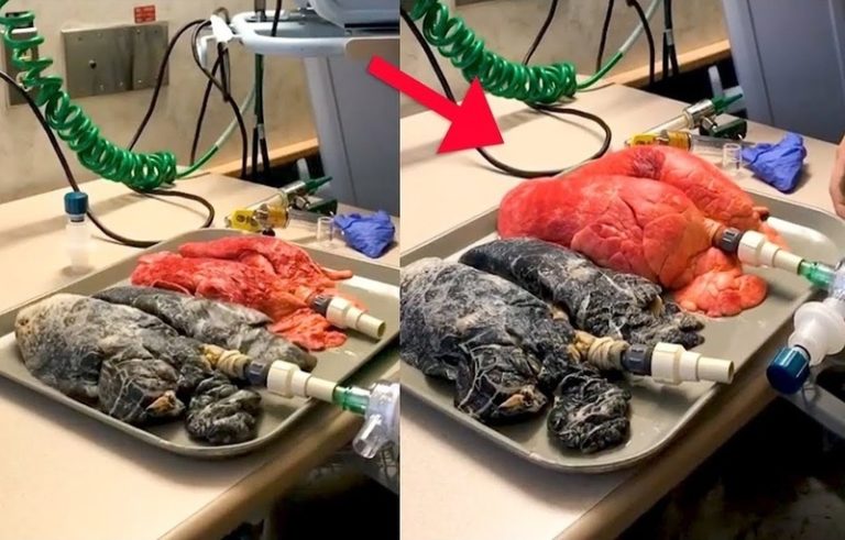 【閲覧注意】タバコ吸ってる奴、マジでヤバいぞ… この動画見ろ…