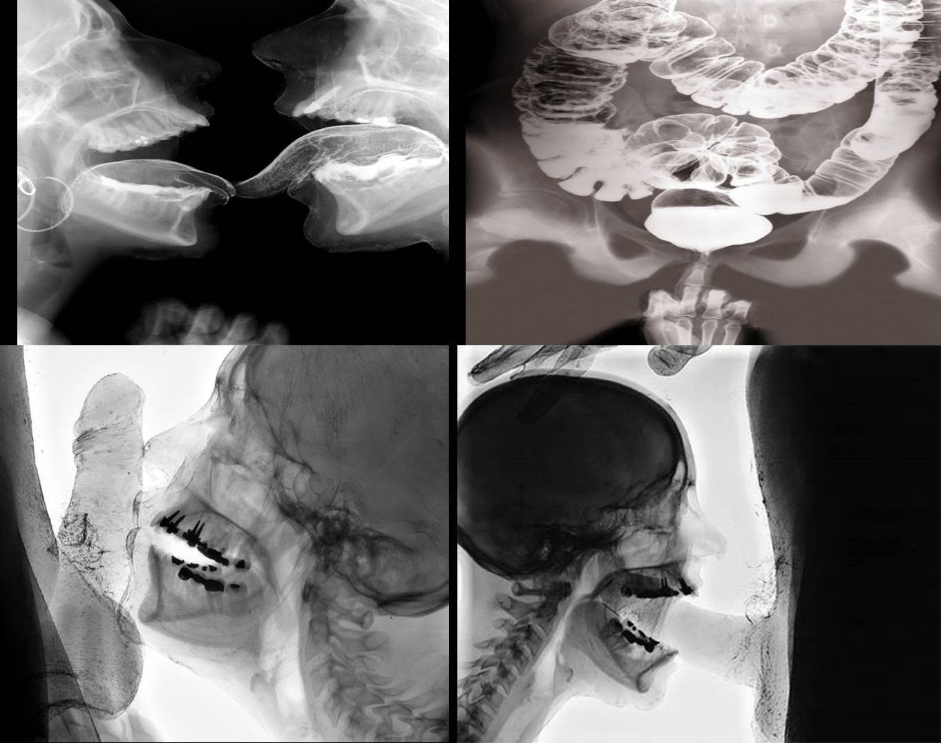 画像】MRIで男女がセ○クスしてる所を見たら凄い事になってた - ポッカキット
