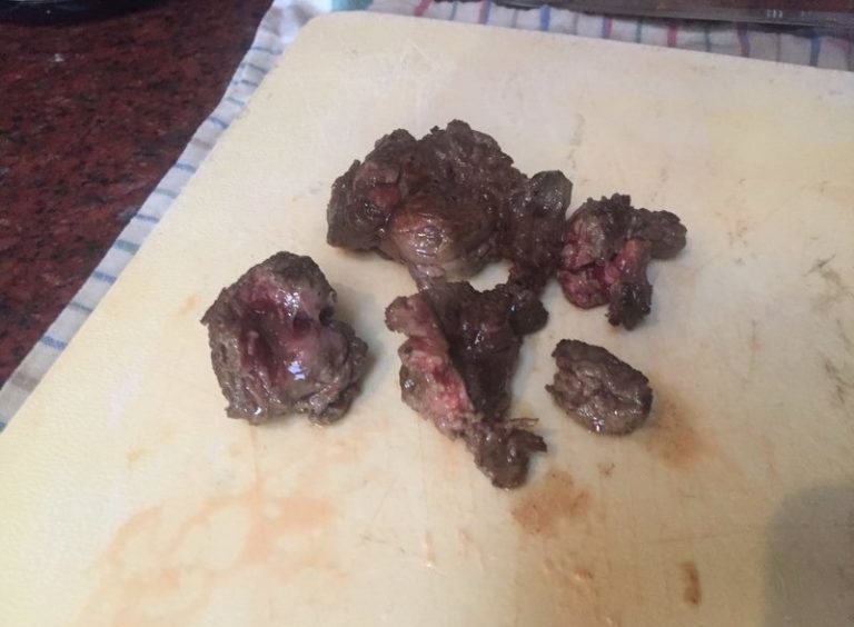 【閲覧注意】交通事故で失った自分の足を食べた人物が驚愕の発言！「その味は…」