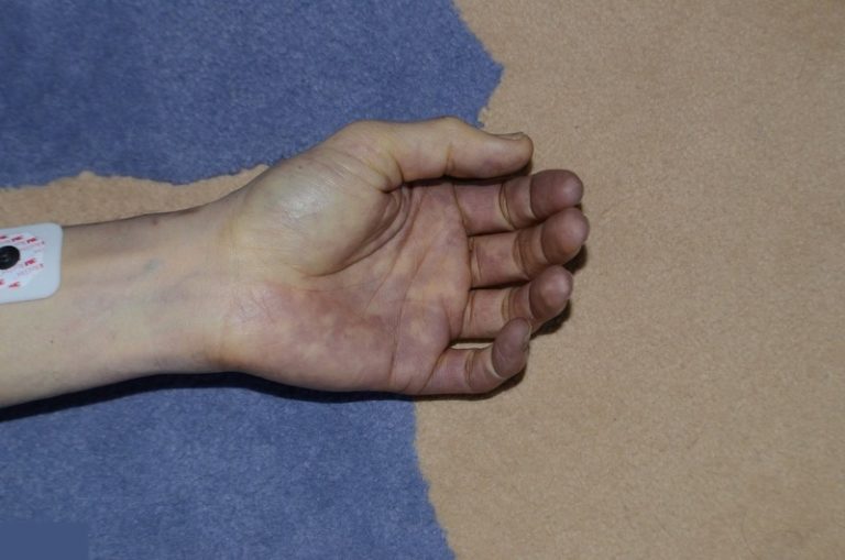 【閲覧注意】”あの超有名人” の「死体写真」がなぜか公開される…（画像あり）