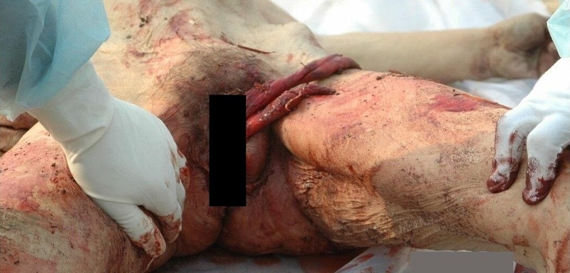 【超！閲覧注意】マ コから腸を出され、その腸で絞め殺された女性が発見される（画像） ポッカキット 
