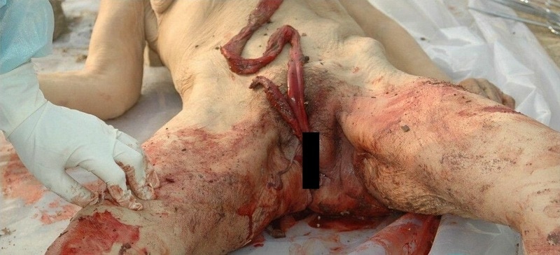 【超！閲覧注意】マ コから腸を出され、その腸で絞め殺された女性が発見される（画像） ポッカキット 
