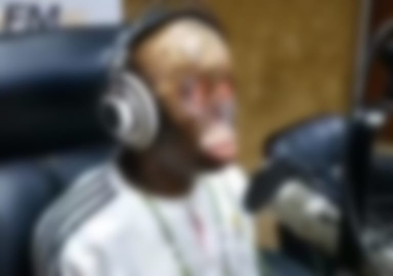 【閲覧注意】とんでもない人物がラジオ出演してしまう。目と鼻と髪がなく、人生に絶望している