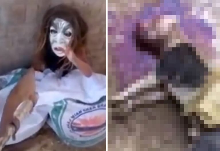 【閲覧注意】未だ存在していた「魔女」。一瞬で大型犬を殺し、牛を裂いてしまう（動画あり）